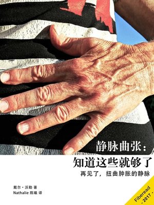 静脉曲张 - ebook